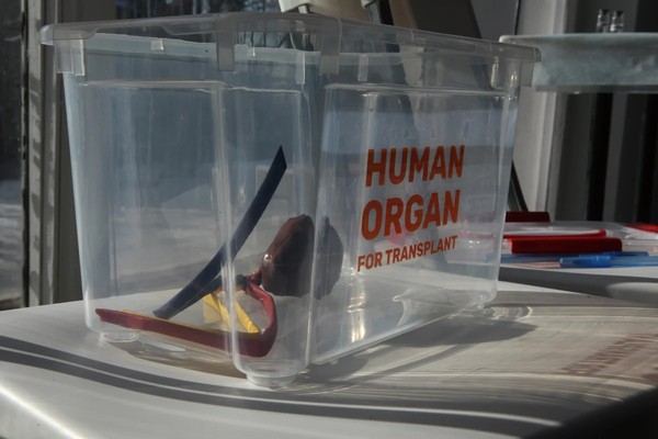 Большая медицинская программа: трансплантология